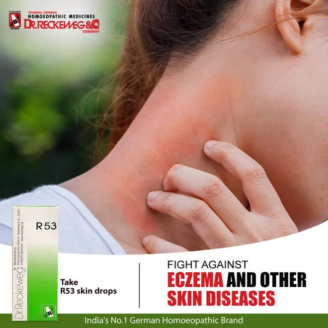 Rhinitis-themed product poster — historical product artwork