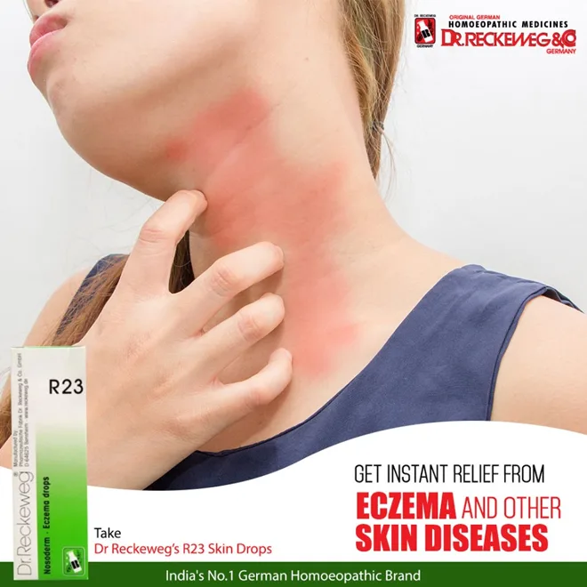 Skin-rash product artwork — historical product artwork